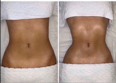 DrenoDetox